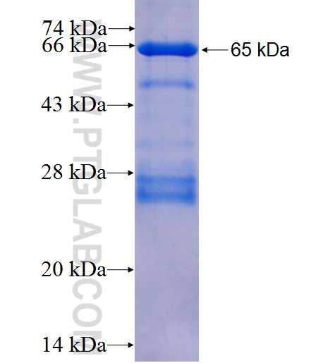 PPP2R5C fusion protein Ag1819 SDS-PAGE