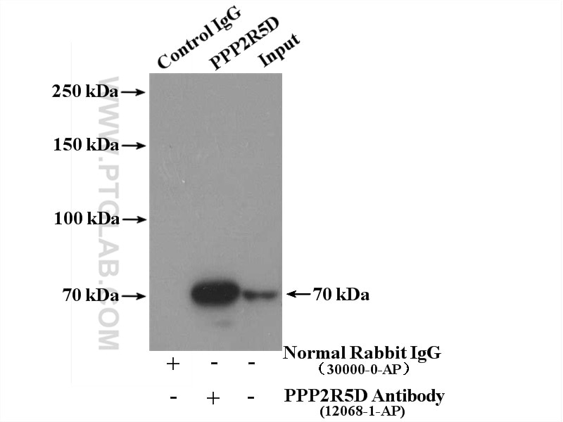 Immunoprecipitation (IP) experiment of Y79 cells using PPP2R5D Polyclonal antibody (12068-1-AP)