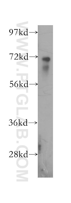 Western Blot (WB) analysis of human brain tissue using PPP2R5D Polyclonal antibody (12068-1-AP)