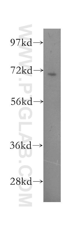 Western Blot (WB) analysis of Y79 cells using PPP2R5D Polyclonal antibody (12068-1-AP)