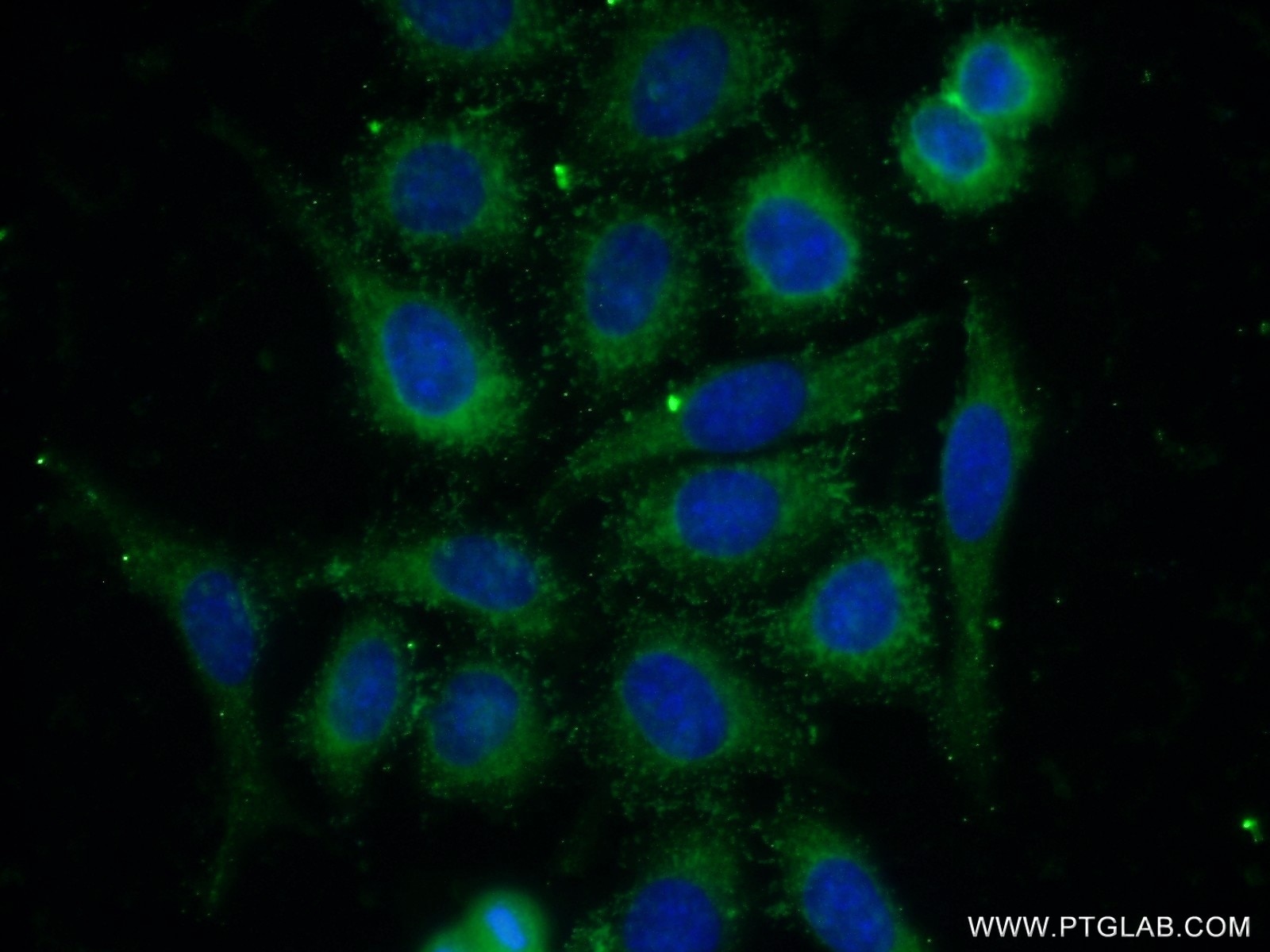Immunofluorescence (IF) / fluorescent staining of HeLa cells using PPP2R5E Polyclonal antibody (23885-1-AP)