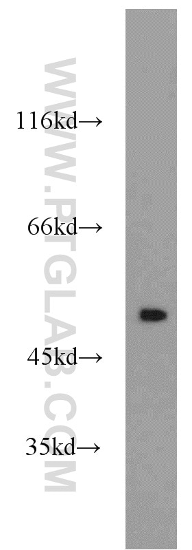 Western Blot (WB) analysis of HeLa cells using PPP2R5E Polyclonal antibody (23885-1-AP)