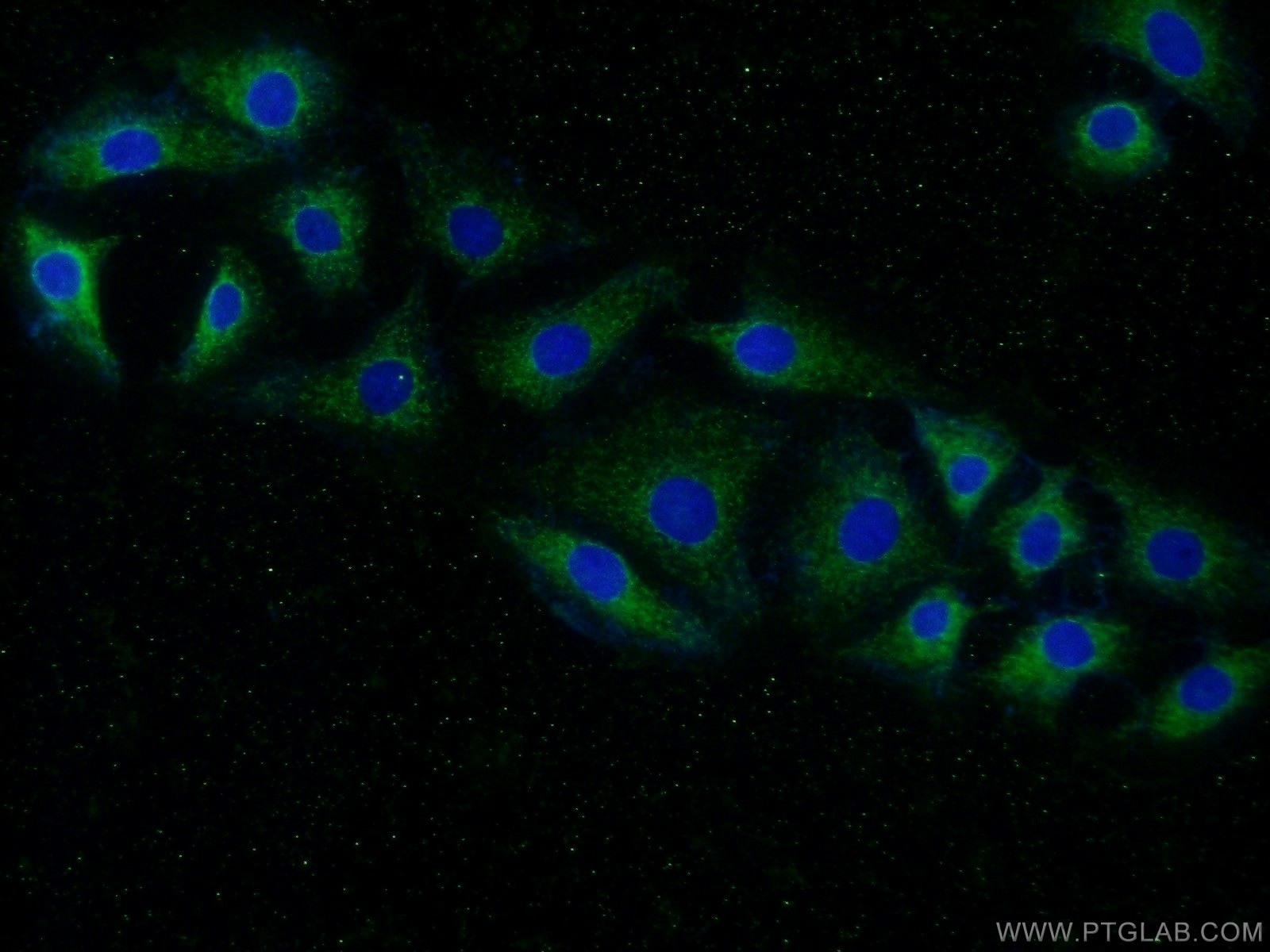 Immunofluorescence (IF) / fluorescent staining of SH-SY5Y cells using PPP3CA Polyclonal antibody (13422-1-AP)