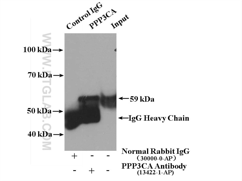 Immunoprecipitation (IP) experiment of mouse heart tissue using PPP3CA Polyclonal antibody (13422-1-AP)