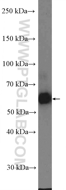 Western Blot (WB) analysis of mouse skeletal muscle tissue using PPP3CA Polyclonal antibody (13422-1-AP)