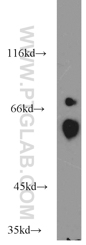Western Blot (WB) analysis of mouse heart tissue using PPP3CA Polyclonal antibody (13422-1-AP)