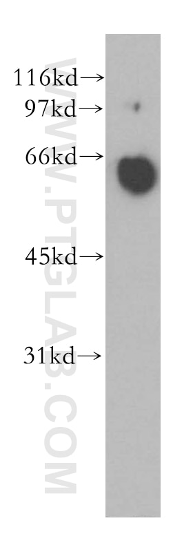Western Blot (WB) analysis of SH-SY5Y cells using PPP3CA Polyclonal antibody (13422-1-AP)