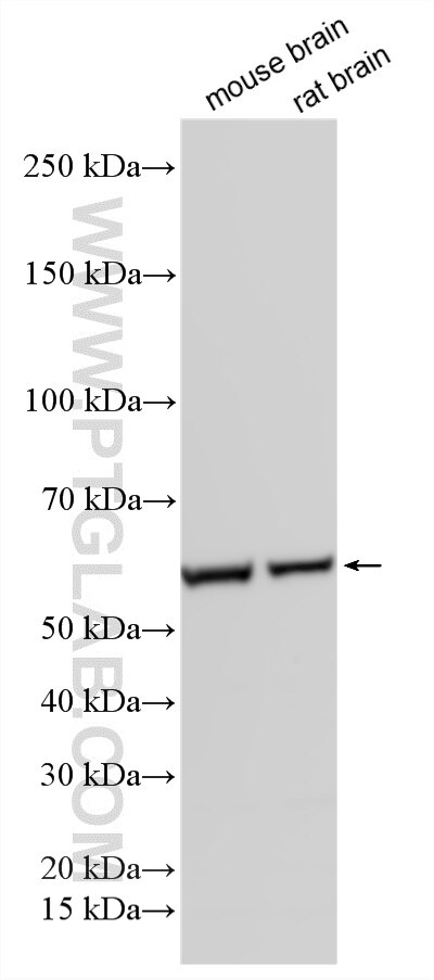 Western Blot (WB) analysis of various lysates using PPP3CA-specific Polyclonal antibody (55147-1-AP)