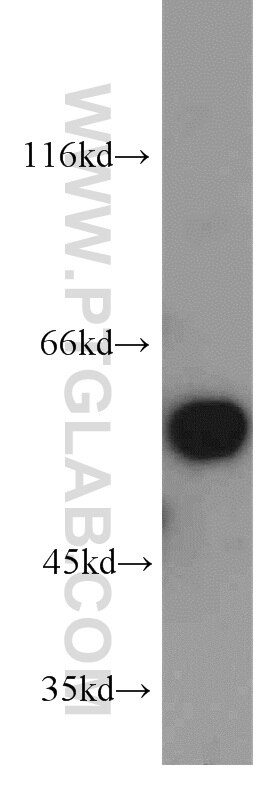 Western Blot (WB) analysis of mouse brain tissue using PPP3CA-specific Polyclonal antibody (55147-1-AP)