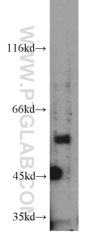Western Blot (WB) analysis of mouse pancreas tissue using PPP3CA-specific Polyclonal antibody (55147-1-AP)