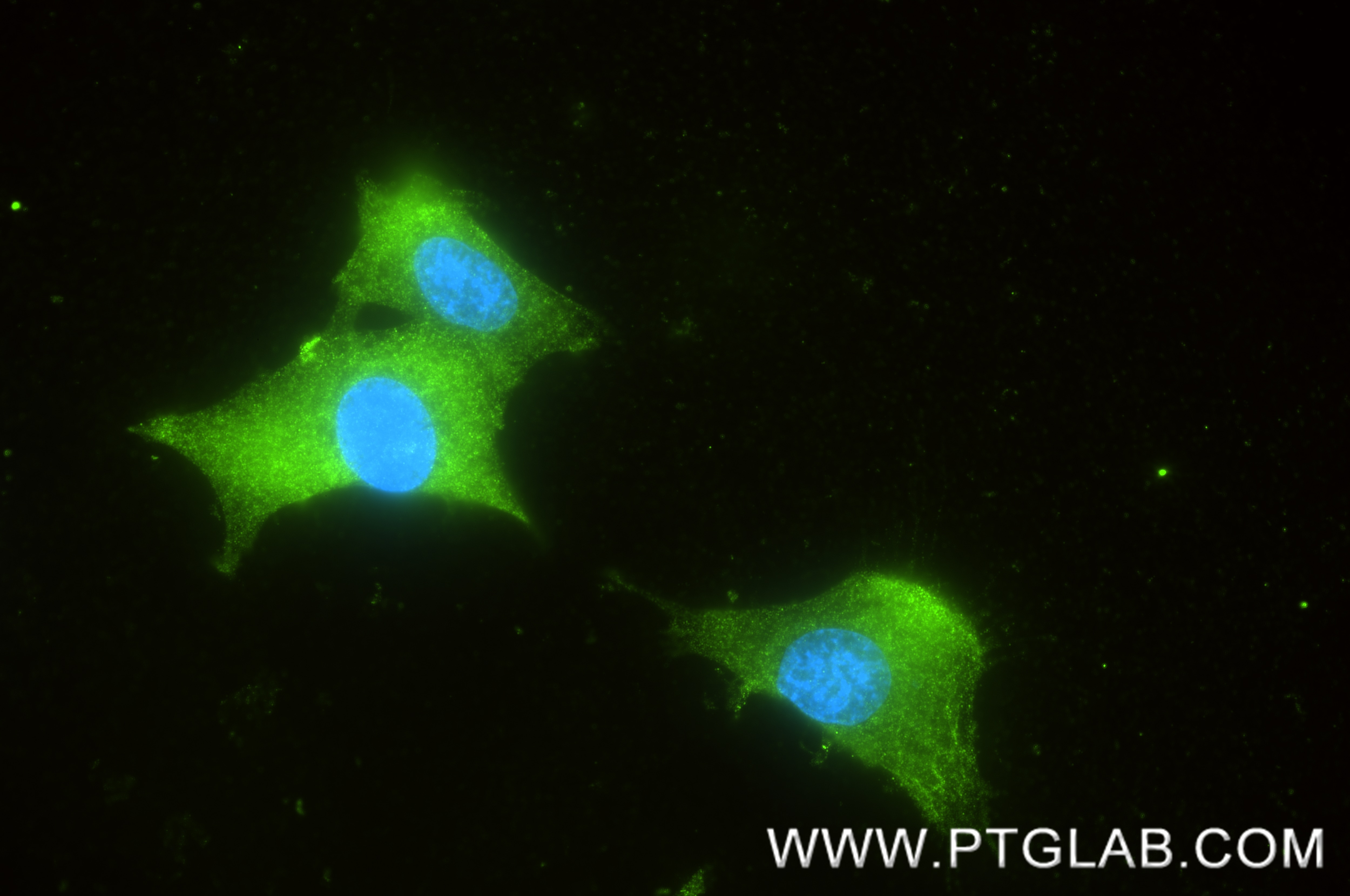 Immunofluorescence (IF) / fluorescent staining of SH-SY5Y cells using PPP3CA Recombinant monoclonal antibody (87902-1-RR)