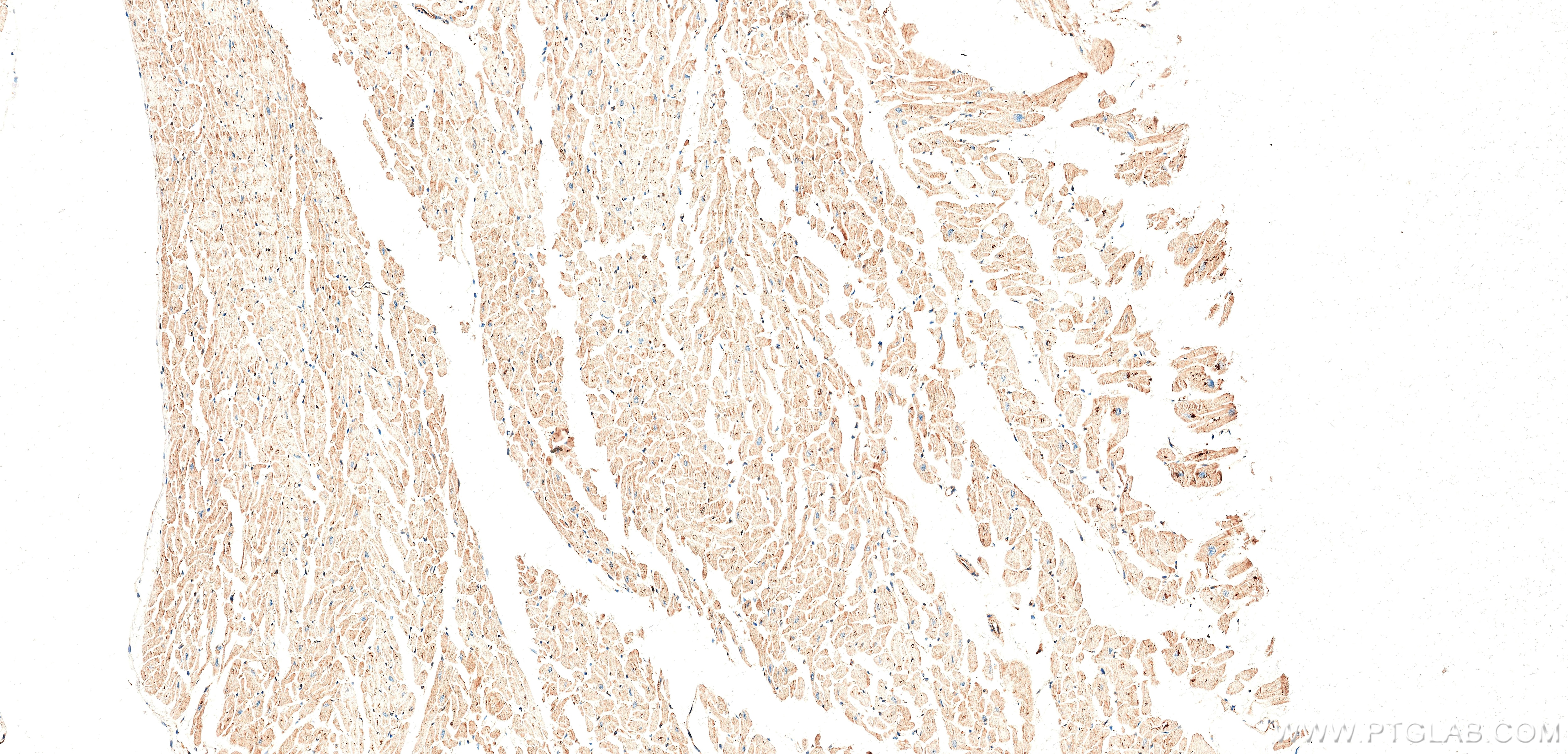 Immunohistochemistry (IHC) staining of human heart tissue using PPP3CA Recombinant monoclonal antibody (87902-1-RR)