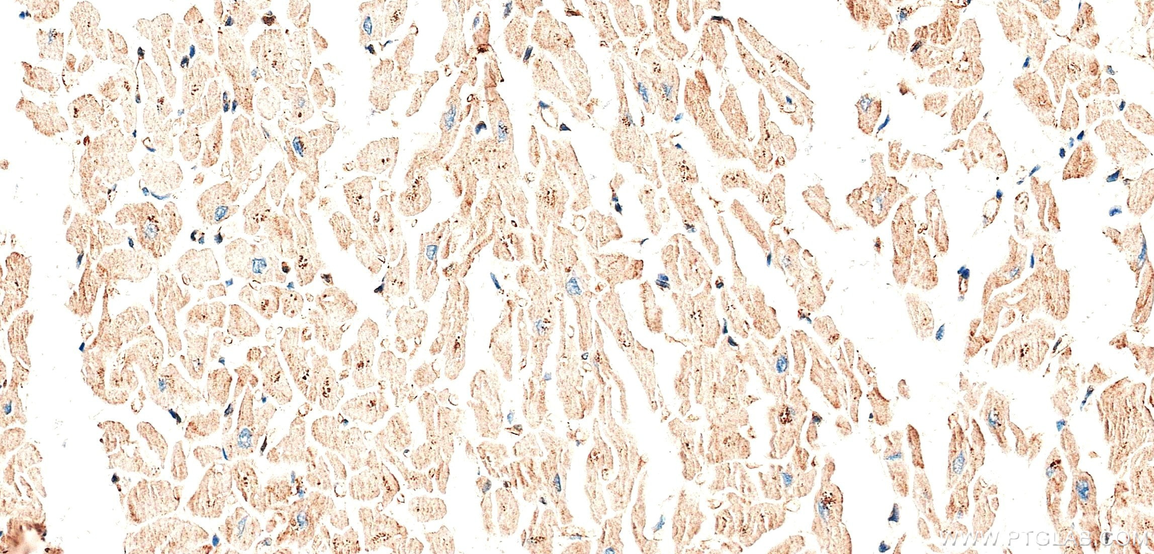 Immunohistochemistry (IHC) staining of human heart tissue using PPP3CA Recombinant monoclonal antibody (87902-1-RR)