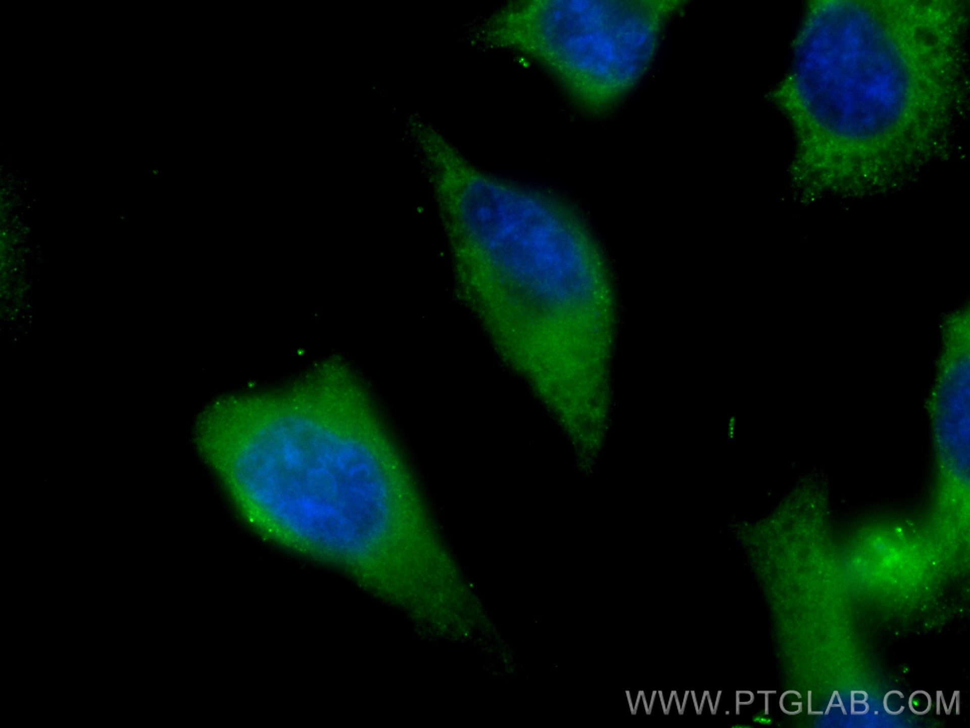 Immunofluorescence (IF) / fluorescent staining of HeLa cells using CoraLite® Plus 488-conjugated PPP3CA Polyclonal an (CL488-13422)