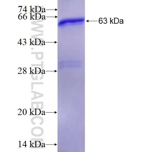 PPP3CA fusion protein Ag4203 SDS-PAGE