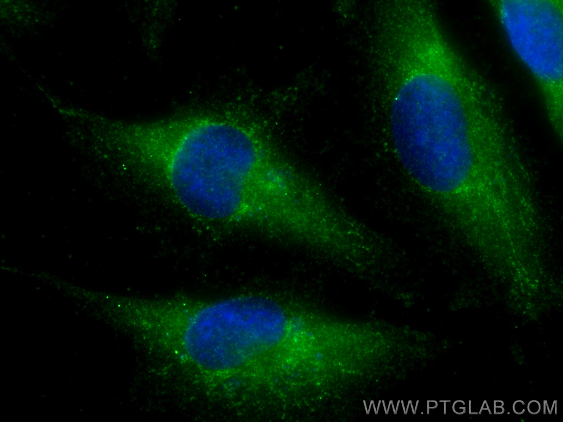 Immunofluorescence (IF) / fluorescent staining of U-251 cells using PPP3CB Polyclonal antibody (13340-1-AP)