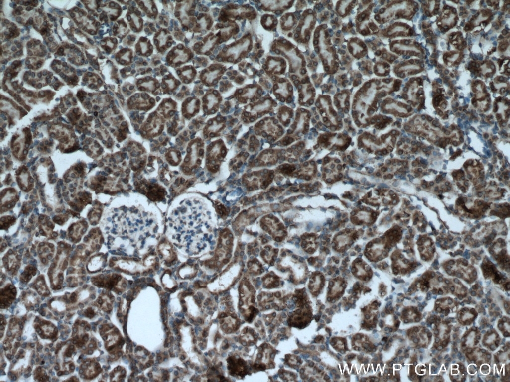 Immunohistochemistry (IHC) staining of mouse kidney tissue using PPP3CB Polyclonal antibody (13340-1-AP)