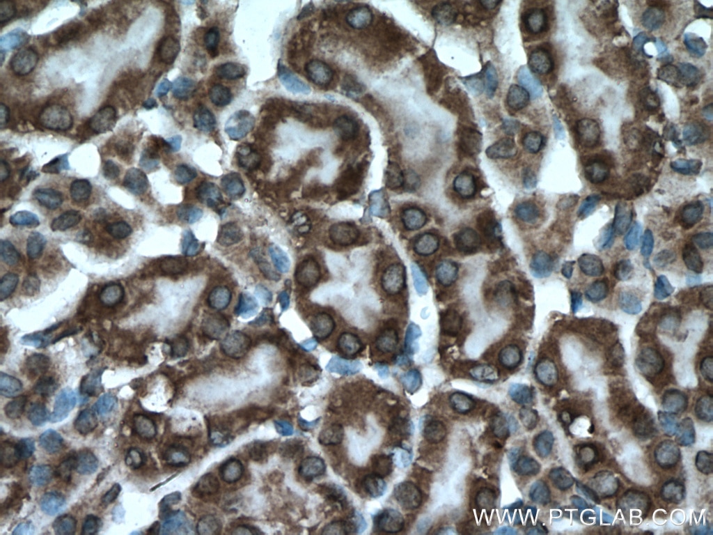 Immunohistochemistry (IHC) staining of mouse kidney tissue using PPP3CB Polyclonal antibody (13340-1-AP)