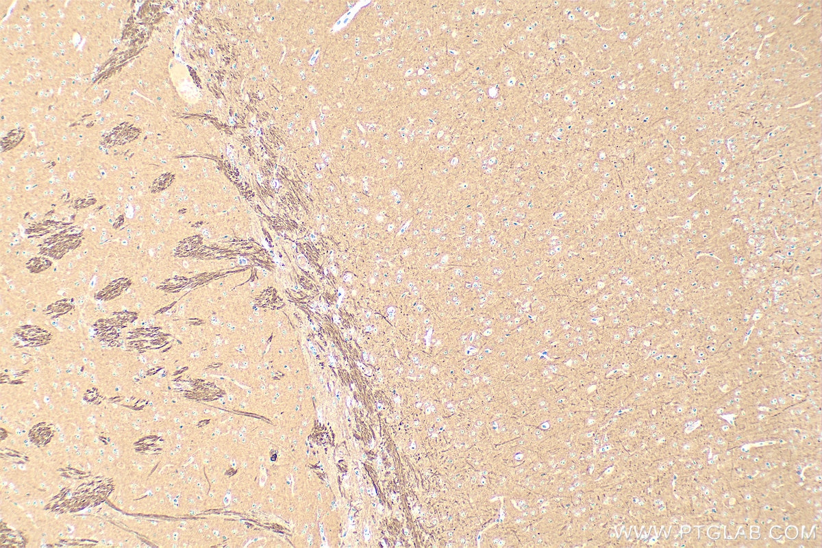 Immunohistochemistry (IHC) staining of mouse brain tissue using PPP3CB Polyclonal antibody (13340-1-AP)