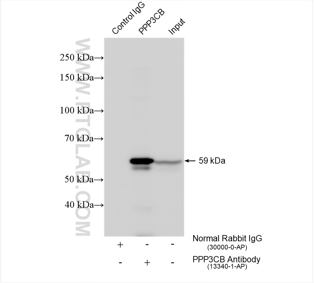 Immunoprecipitation (IP) experiment of mouse brain tissue using PPP3CB Polyclonal antibody (13340-1-AP)
