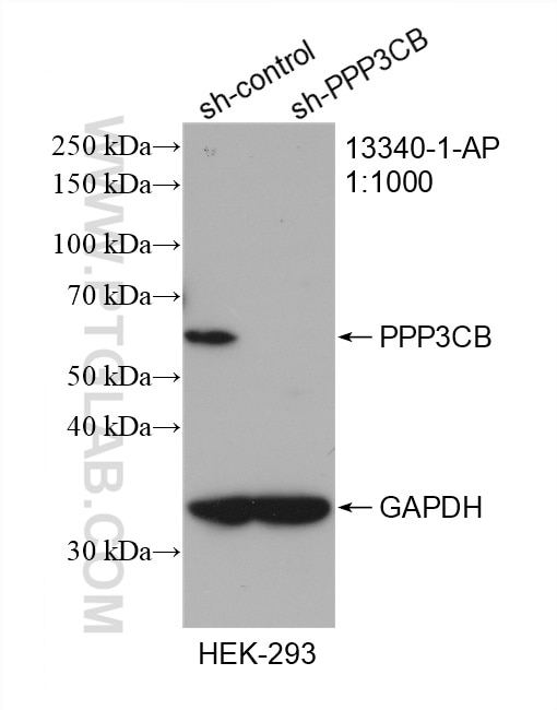 Western Blot (WB) analysis of HEK-293 cells using PPP3CB Polyclonal antibody (13340-1-AP)