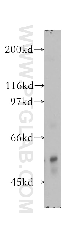 Western Blot (WB) analysis of human heart tissue using PPP3CB Polyclonal antibody (13340-1-AP)