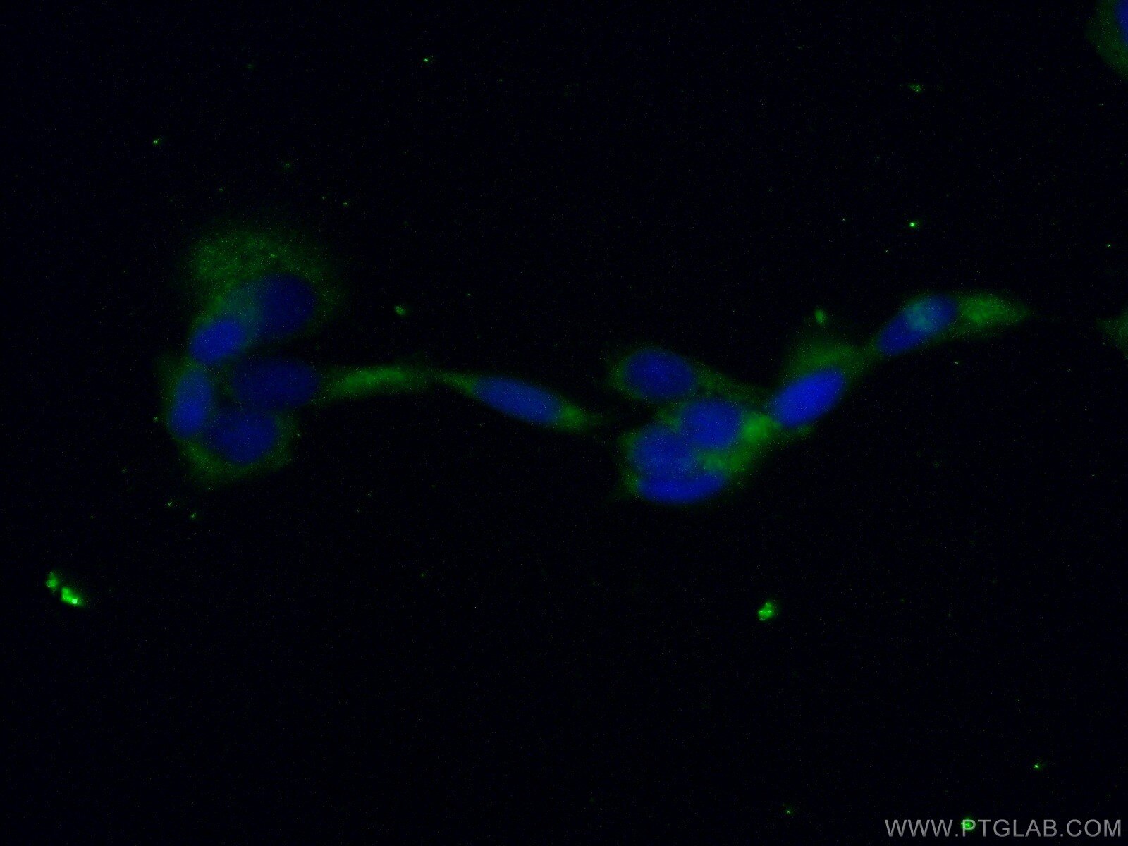 Immunofluorescence (IF) / fluorescent staining of A431 cells using PPP3CB-specific Polyclonal antibody (55148-1-AP)