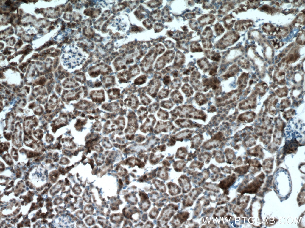 Immunohistochemistry (IHC) staining of mouse kidney tissue using PPP3CB-specific Polyclonal antibody (55148-1-AP)
