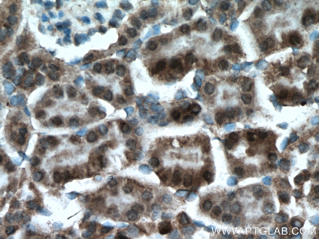 Immunohistochemistry (IHC) staining of mouse kidney tissue using PPP3CB-specific Polyclonal antibody (55148-1-AP)
