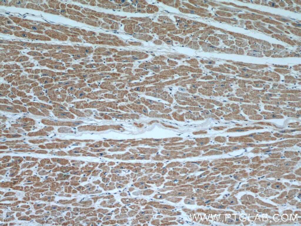 IHC staining of human heart using 55148-1-AP