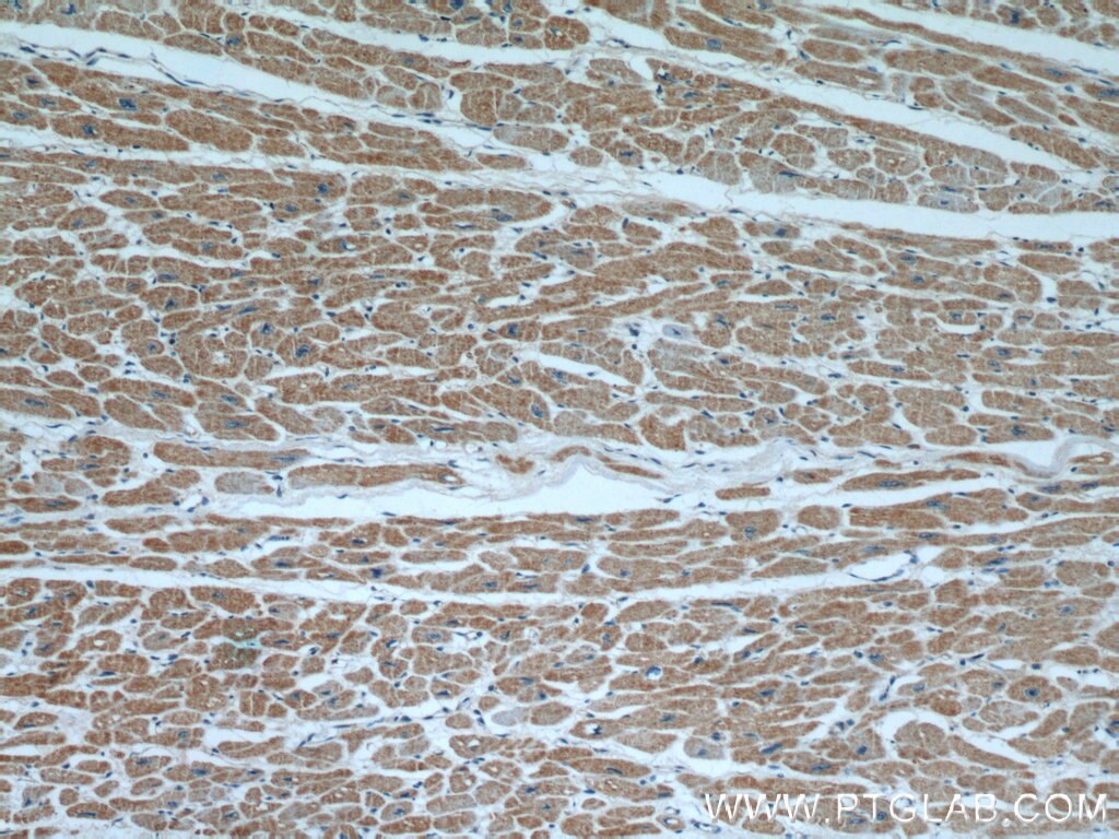 Immunohistochemistry (IHC) staining of human heart tissue using PPP3CB-specific Polyclonal antibody (55148-1-AP)