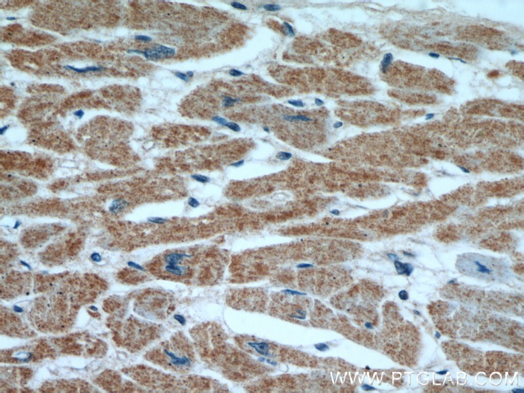 Immunohistochemistry (IHC) staining of human heart tissue using PPP3CB-specific Polyclonal antibody (55148-1-AP)