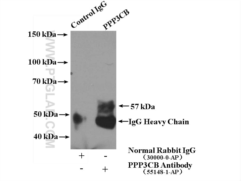 Immunoprecipitation (IP) experiment of mouse brain tissue using PPP3CB-specific Polyclonal antibody (55148-1-AP)