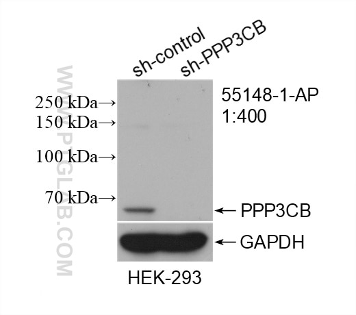 Western Blot (WB) analysis of HEK-293 cells using PPP3CB-specific Polyclonal antibody (55148-1-AP)