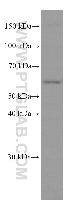 Western Blot (WB) analysis of NIH/3T3 cells using PPP3CB Monoclonal antibody (66614-1-Ig)