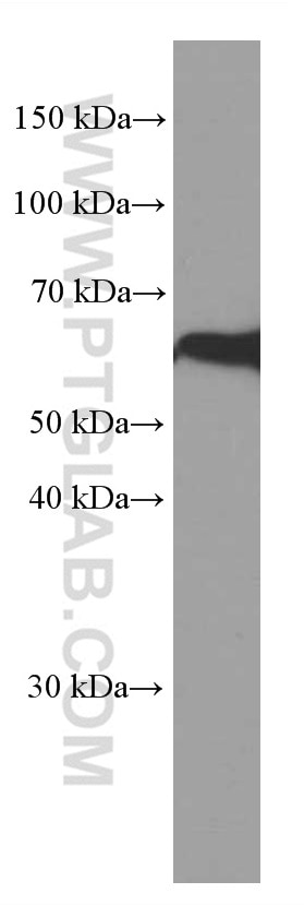 Western Blot (WB) analysis of fetal human brain tissue using PPP3CB Monoclonal antibody (66614-1-Ig)
