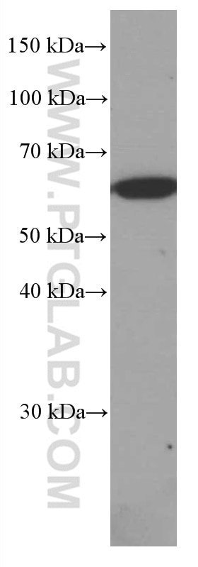 Western Blot (WB) analysis of rat brain tissue using PPP3CB Monoclonal antibody (66614-1-Ig)