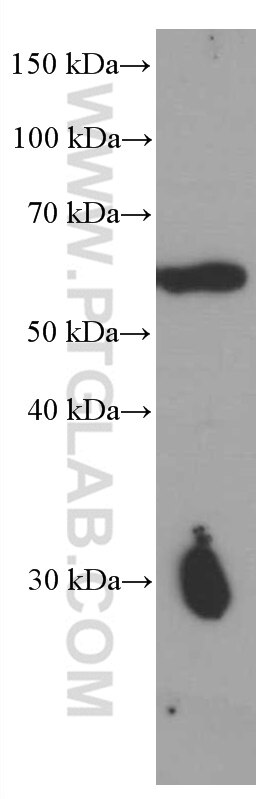 Western Blot (WB) analysis of mouse brain tissue using PPP3CB Monoclonal antibody (66614-1-Ig)