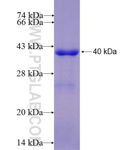 PPP3CB fusion protein Ag27604 SDS-PAGE