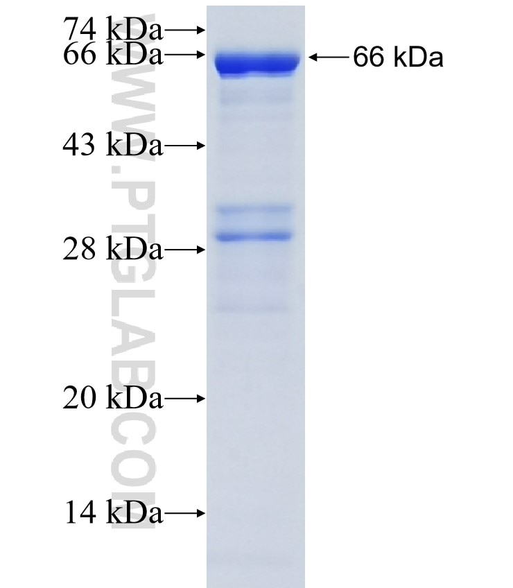 PPP3CB fusion protein Ag28462 SDS-PAGE