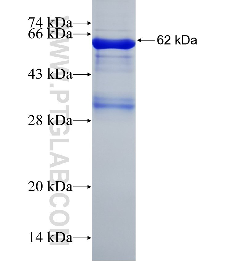 PPP3CB fusion protein Ag4163 SDS-PAGE