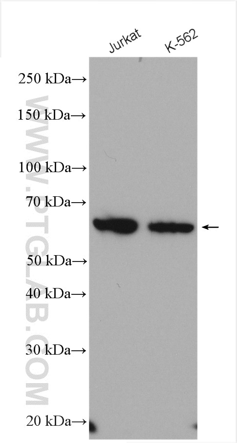 Western Blot (WB) analysis of various lysates using PPP3CC Polyclonal antibody (15582-1-AP)