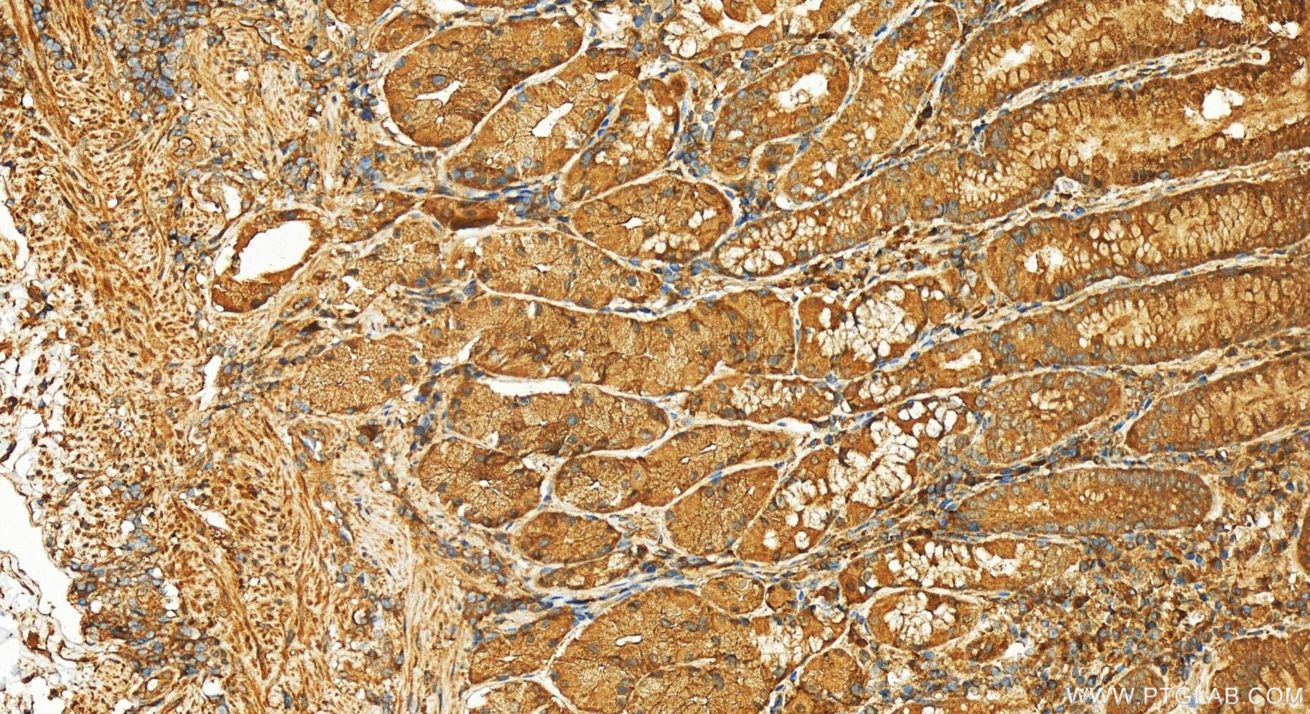 Immunohistochemistry (IHC) staining of human stomach tissue using PPP3CC Polyclonal antibody (19653-1-AP)