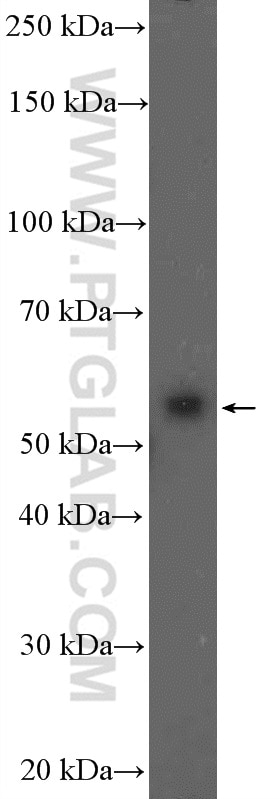 Western Blot (WB) analysis of Jurkat cells using PPP3CC Polyclonal antibody (19653-1-AP)