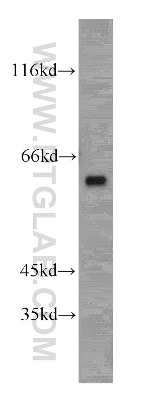 Western Blot (WB) analysis of mouse testis tissue using PPP3CC Polyclonal antibody (19653-1-AP)