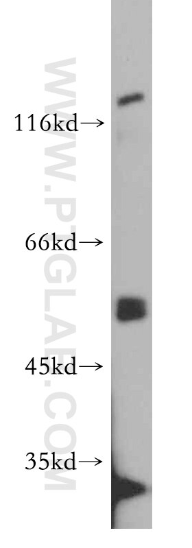 Western Blot (WB) analysis of MCF-7 cells using PPP3CC Polyclonal antibody (19653-1-AP)