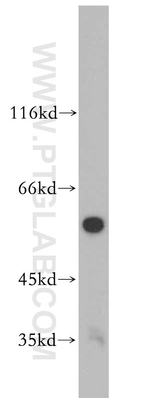 Western Blot (WB) analysis of human testis tissue using PPP3CC Polyclonal antibody (19653-1-AP)