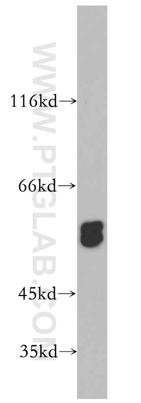 Western Blot (WB) analysis of mouse skeletal muscle tissue using PPP3CC Polyclonal antibody (19653-1-AP)