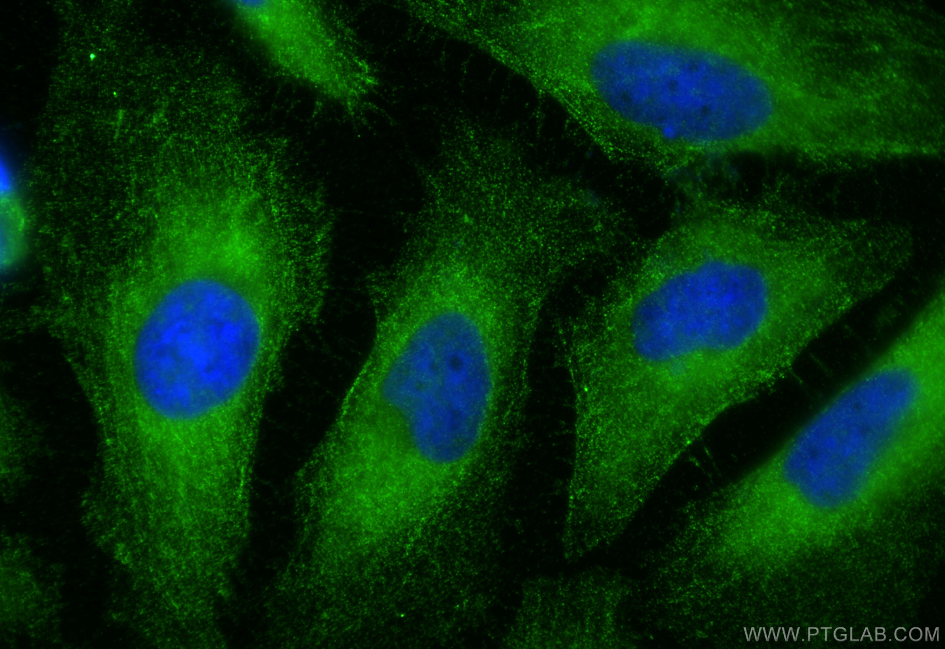 Immunofluorescence (IF) / fluorescent staining of HeLa cells using PPP3R1 Polyclonal antibody (13210-1-AP)