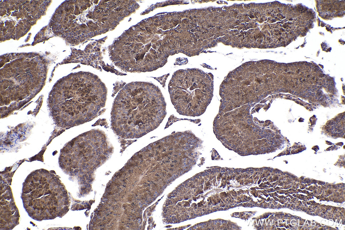 Immunohistochemistry (IHC) staining of mouse testis tissue using PPP3R1 Polyclonal antibody (13210-1-AP)